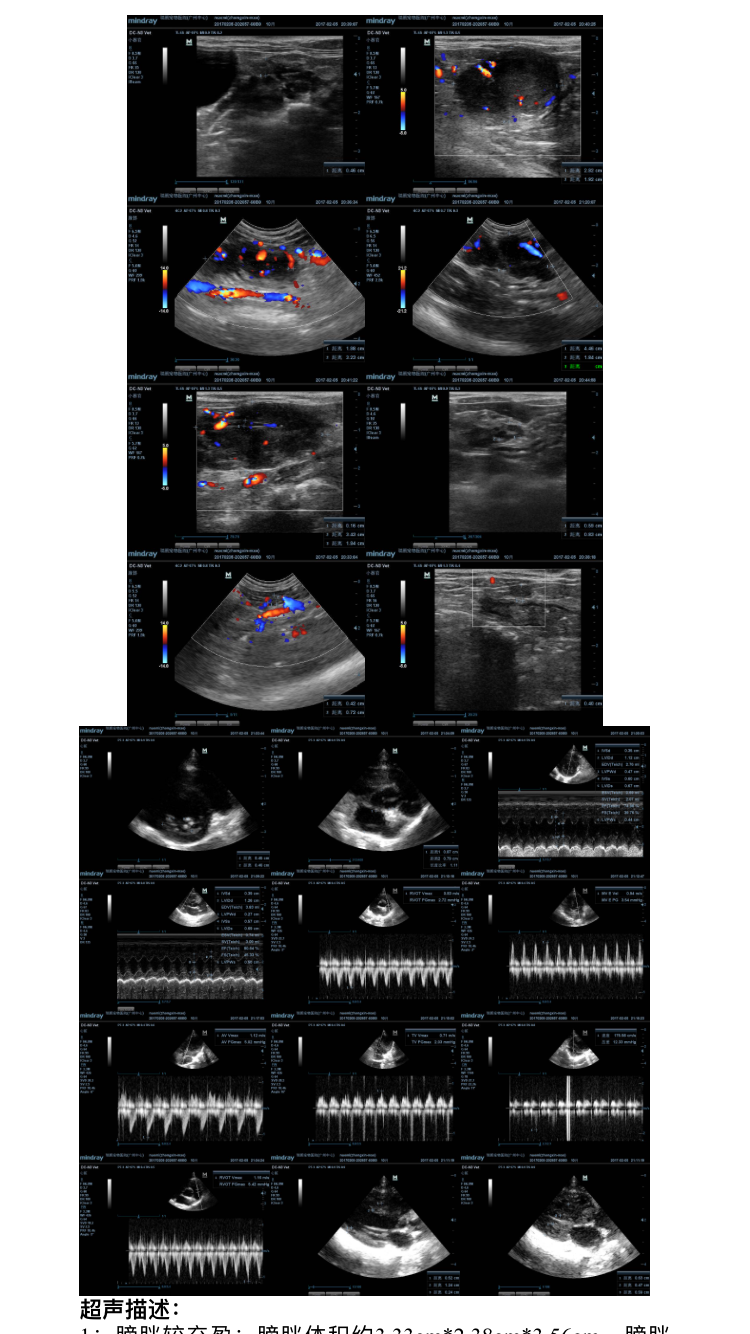 帮我看一下我家猫的超声报告单结果