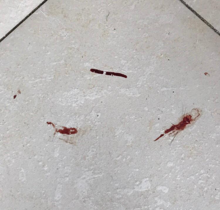 请问这个血迹是怎么引起的呢? 请问这个血迹是怎么引起的呢?