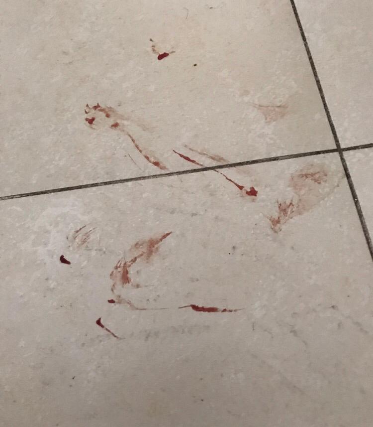 请问这个血迹是怎么引起的呢? 请问这个血迹是怎么引起的呢?