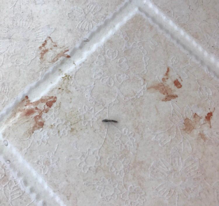 请问这个血迹是怎么引起的呢? 请问这个血迹是怎么引起的呢?