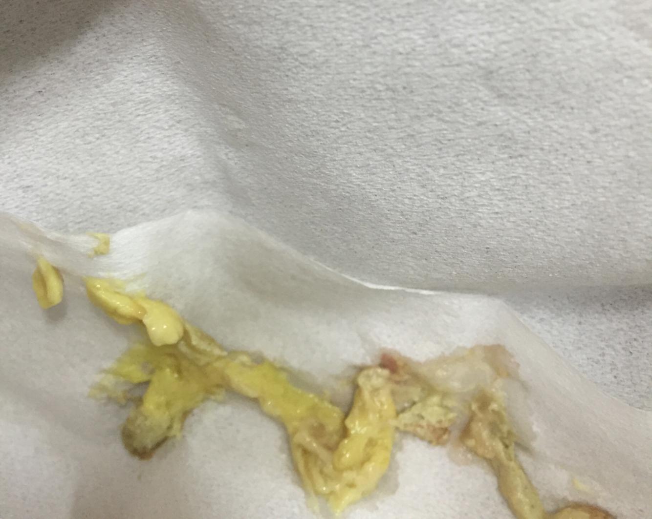 喝奶也很正常  但是就是有点拉稀   拉出来的便便是成条状的  鹅黄色