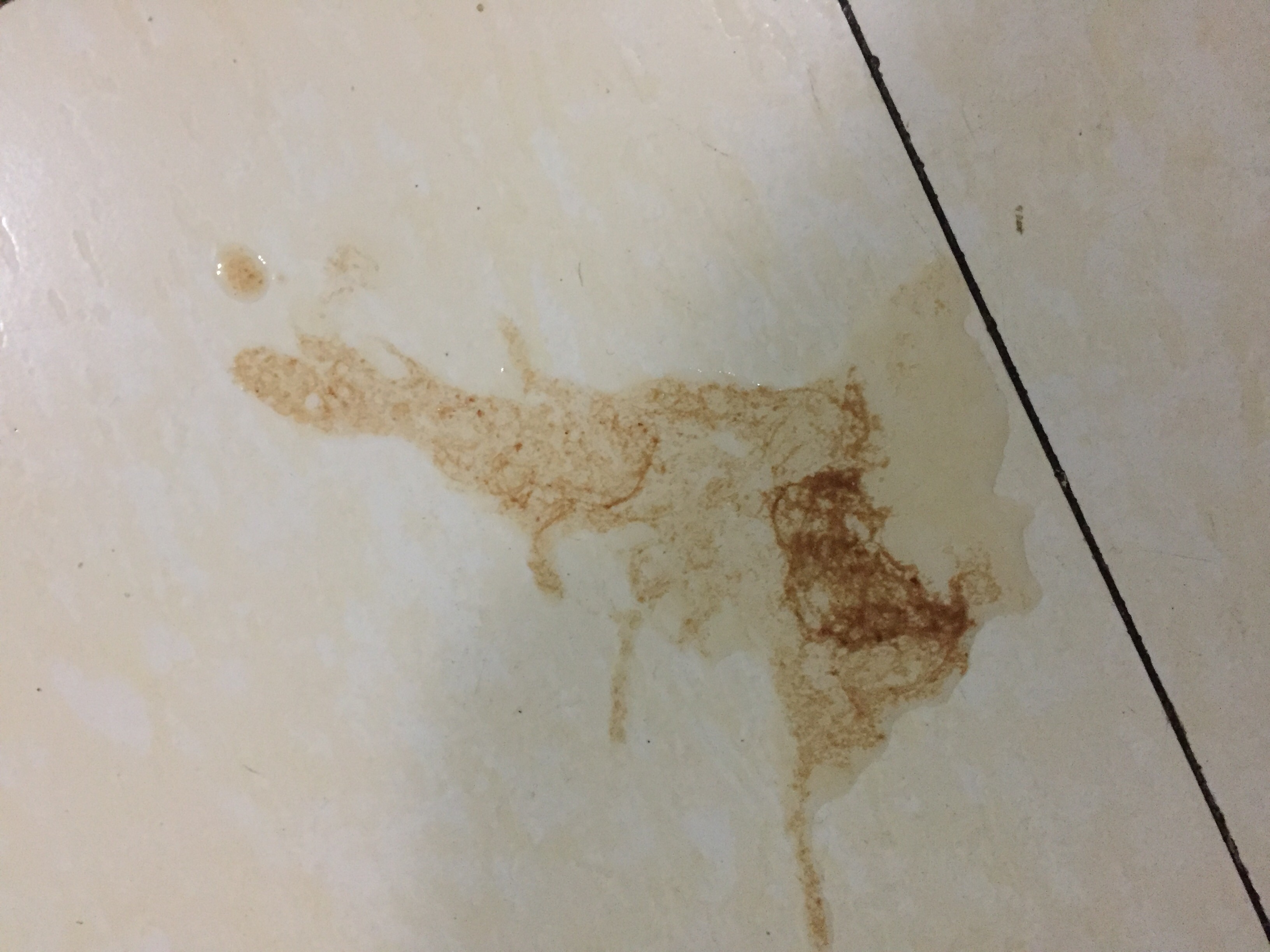呕吐