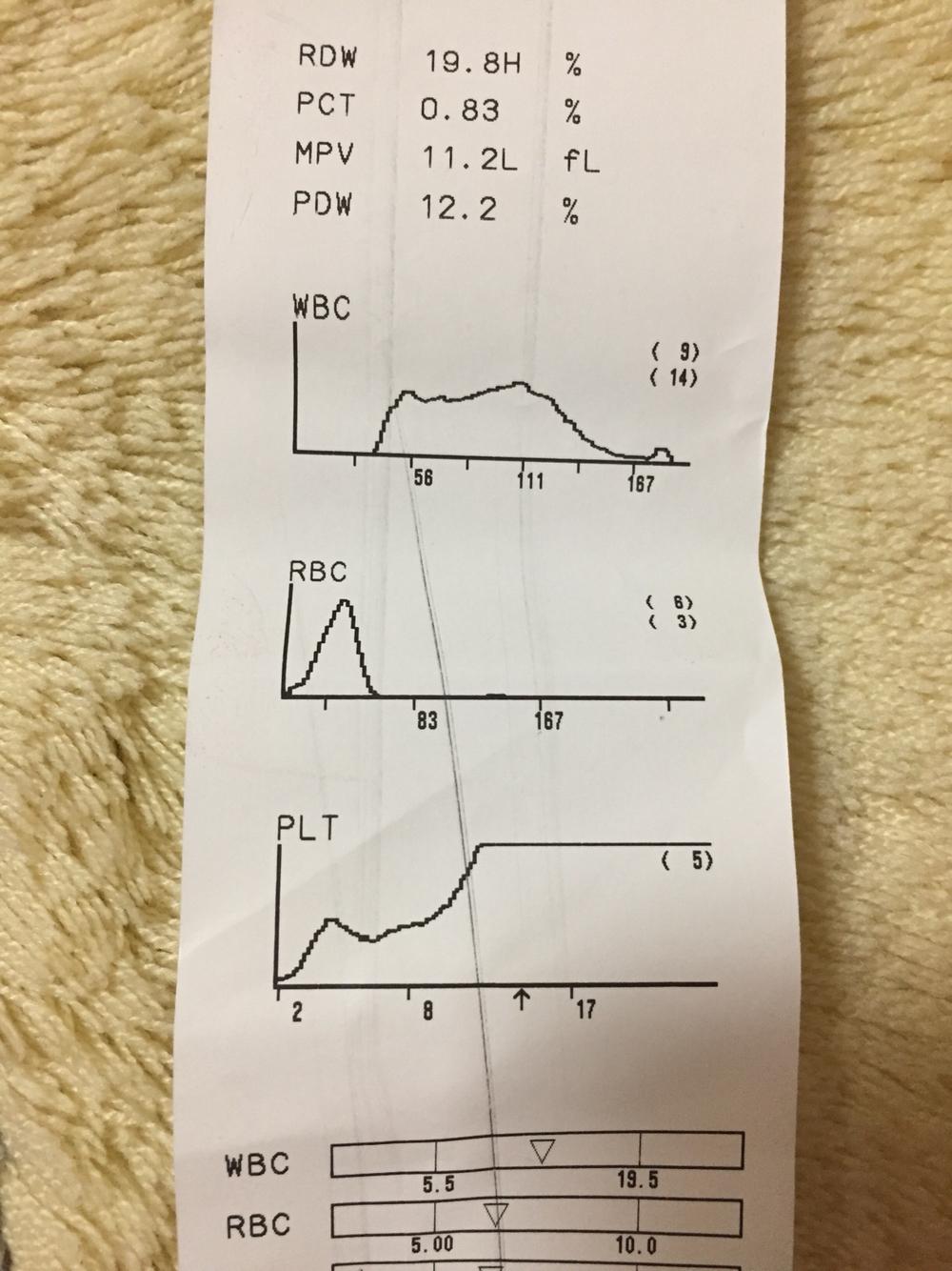 眼睛分泌物多红肿,打喷嚏 眼睛分泌物多红肿,打喷嚏