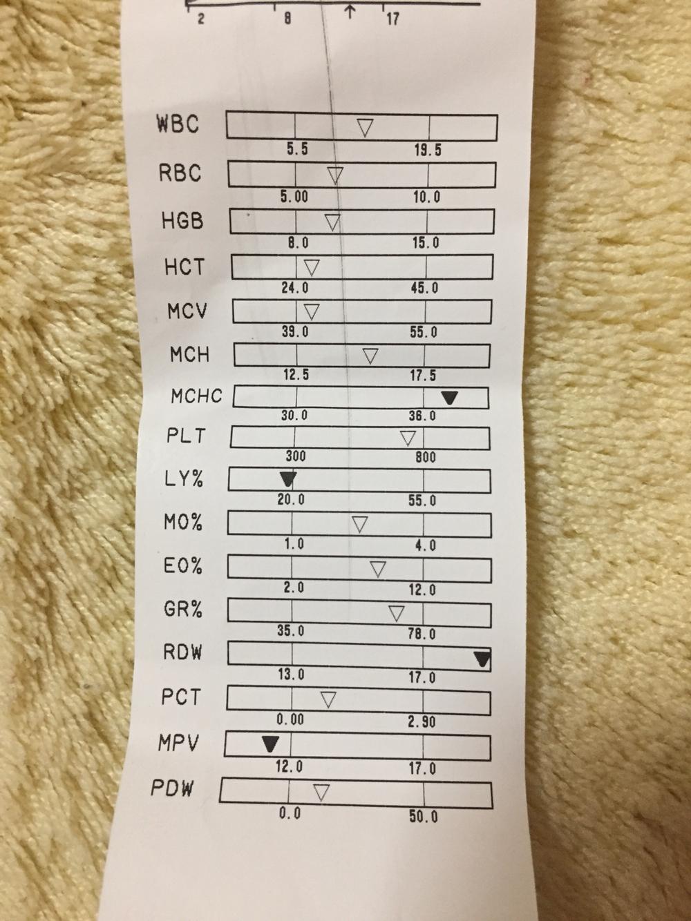 眼睛分泌物多红肿,打喷嚏 眼睛分泌物多红肿,打喷嚏