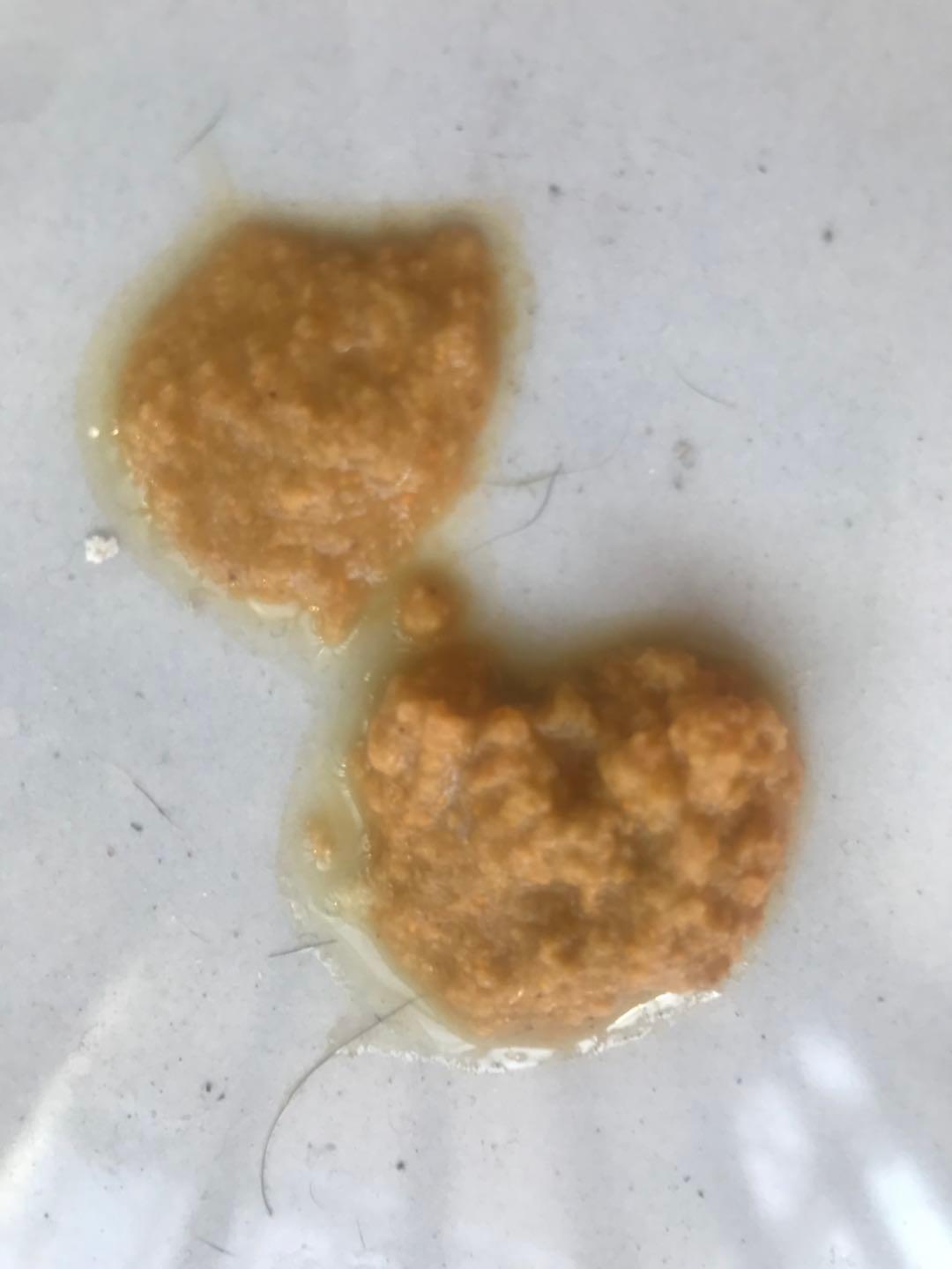梦见自己月经来了，探索梦境背后的深层含义与心理解析
