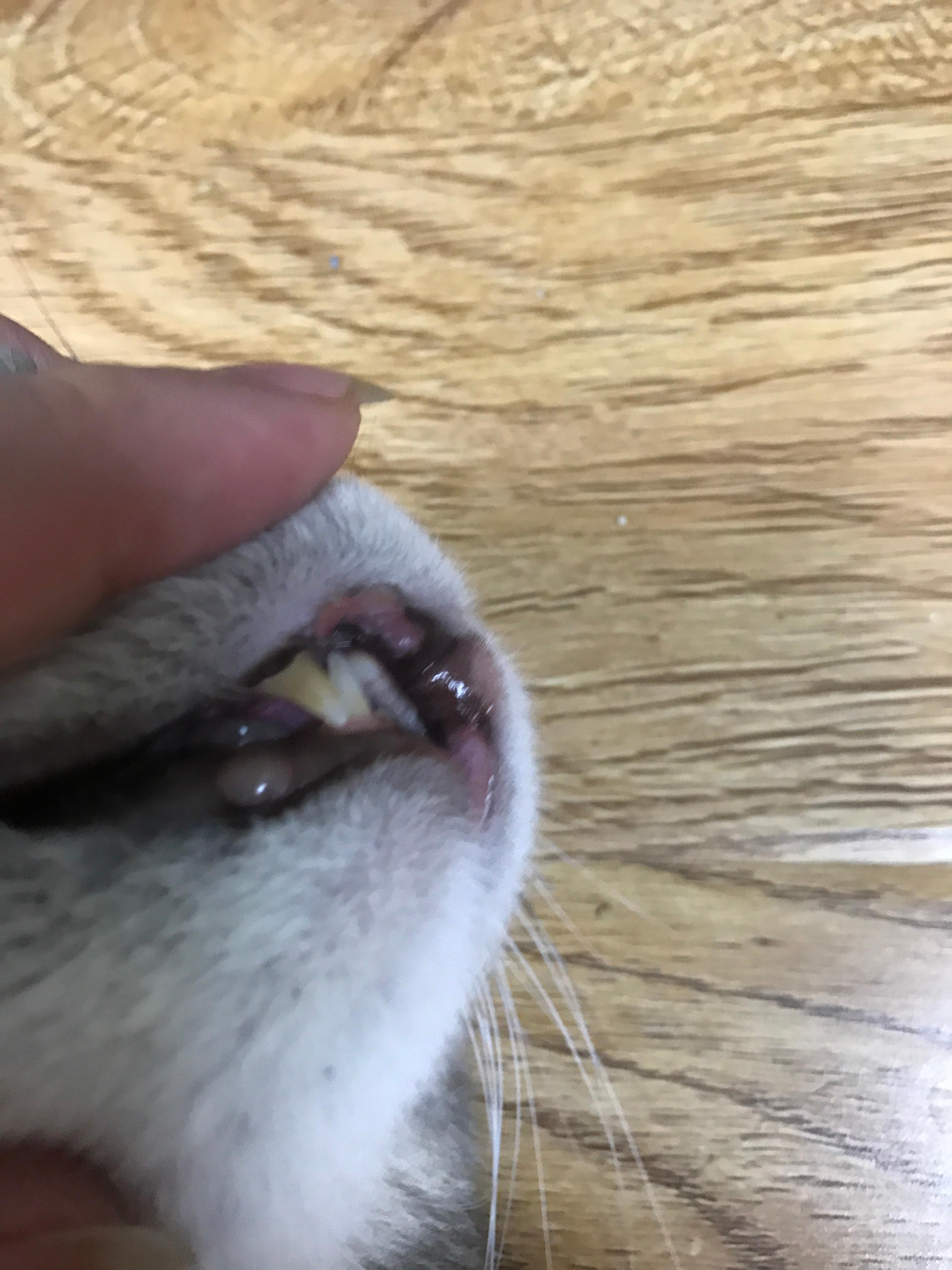 口腔溃疡