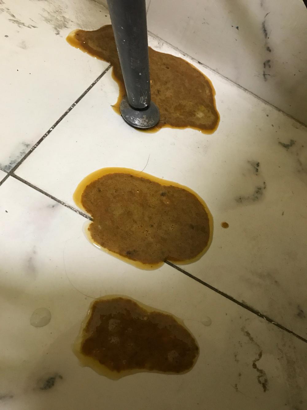 呕吐及大便我都拍了照片.