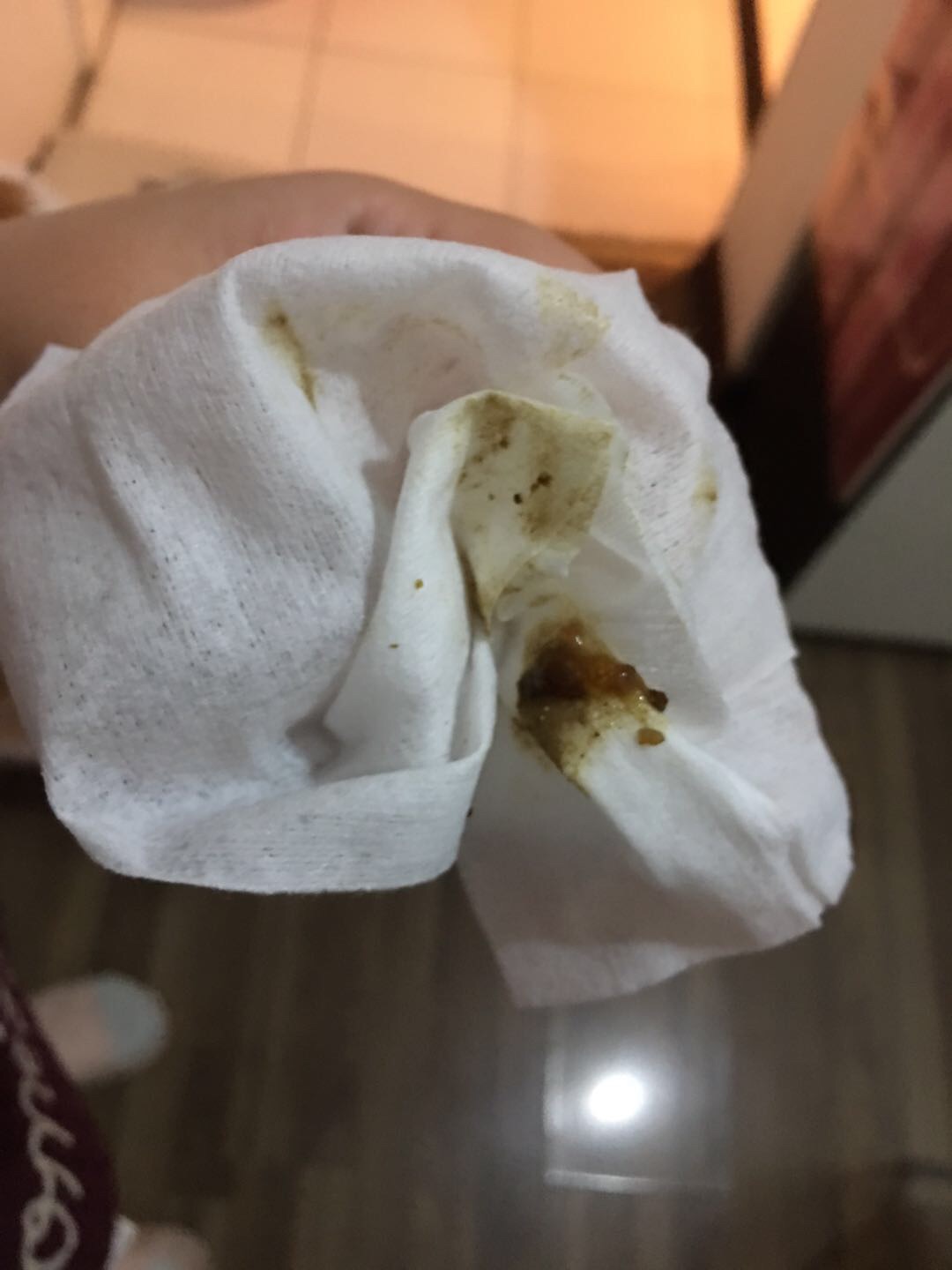 腹泻 软便 腹泻 软便