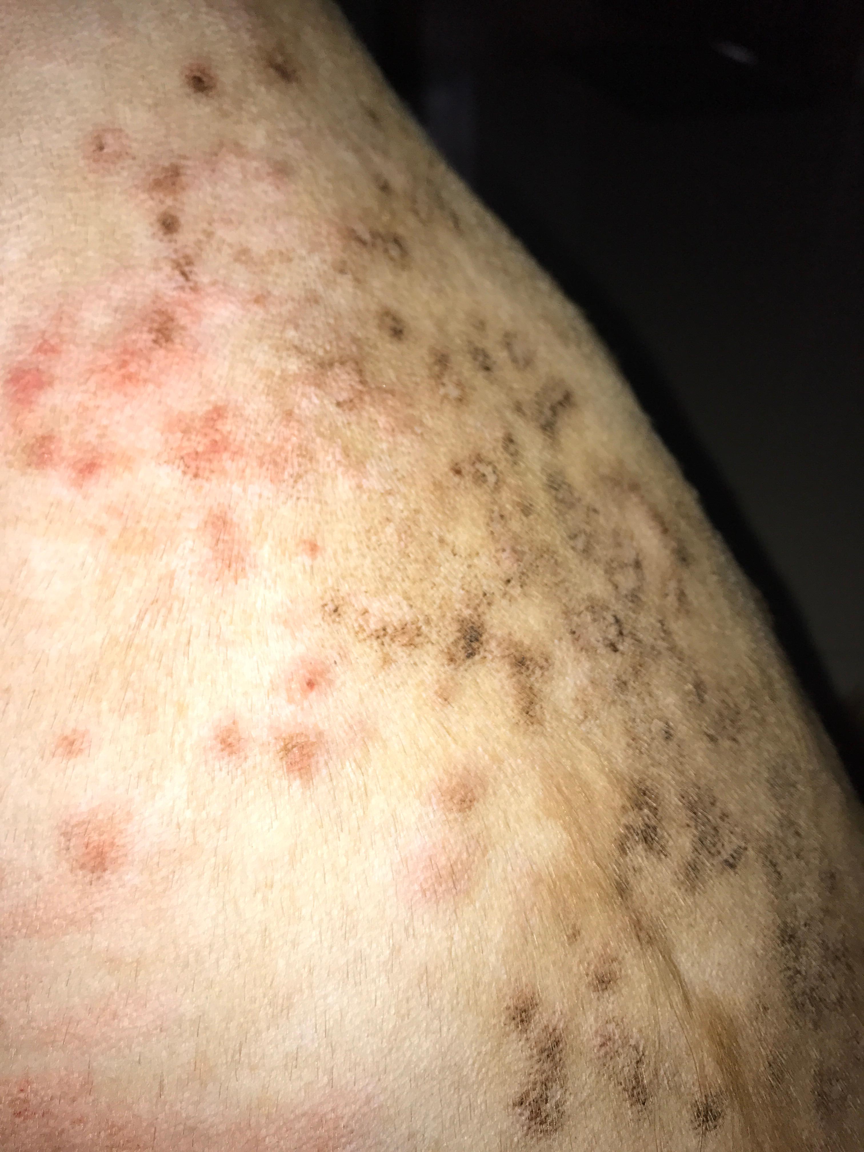 狗狗剃毛之后发现的皮肤问题