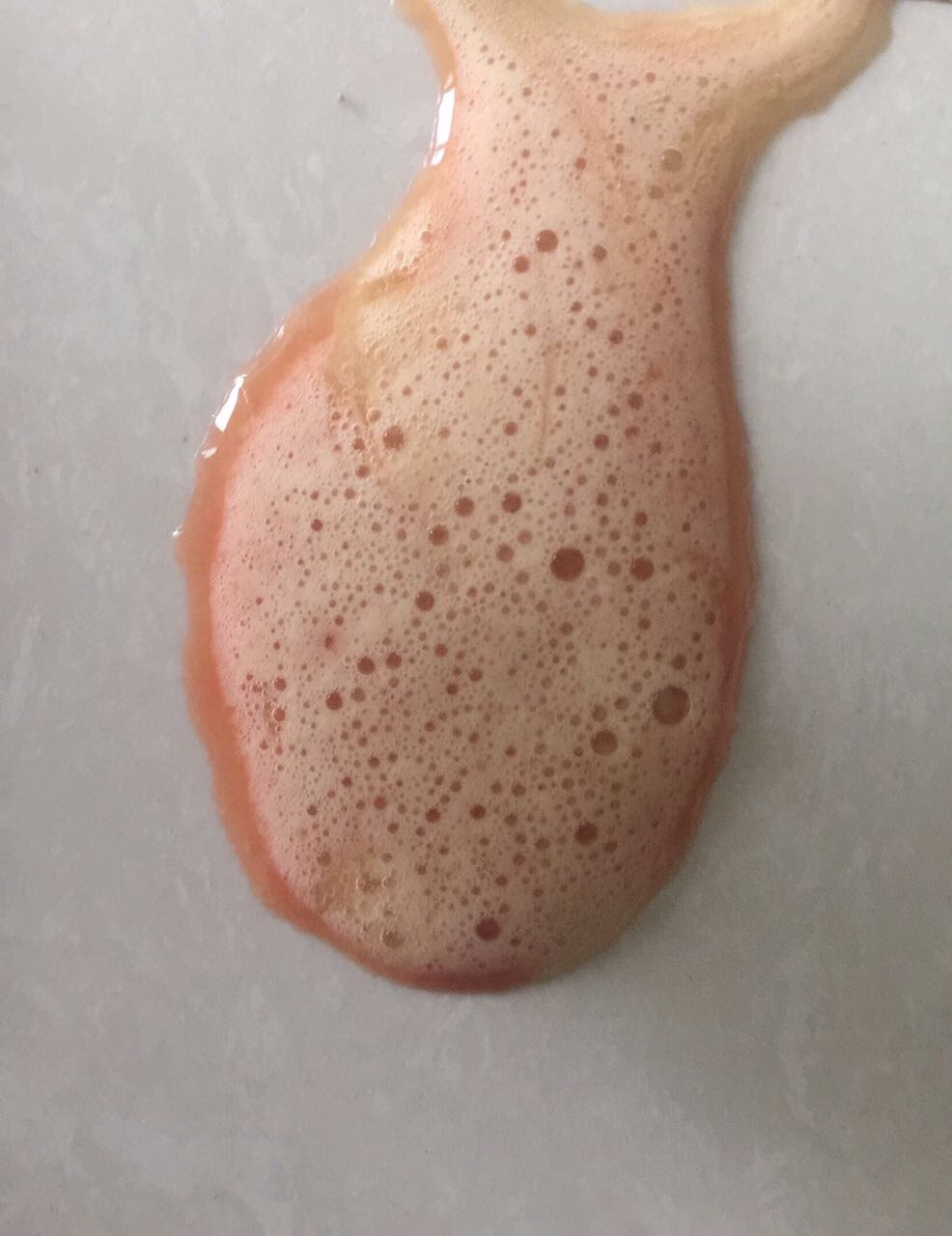 突然呕吐不知道是不是血